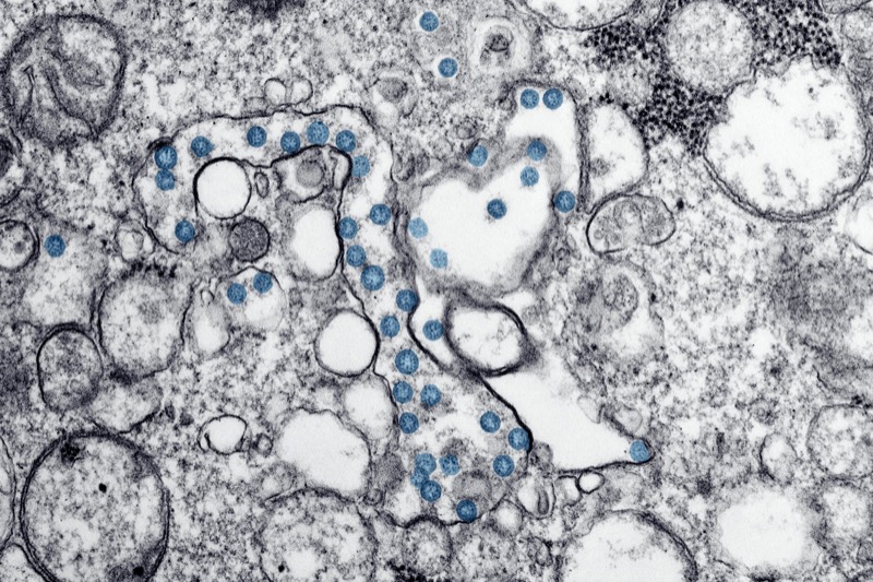 Microscopic view of microbiome organisms showing the complex ecosystem within our gut